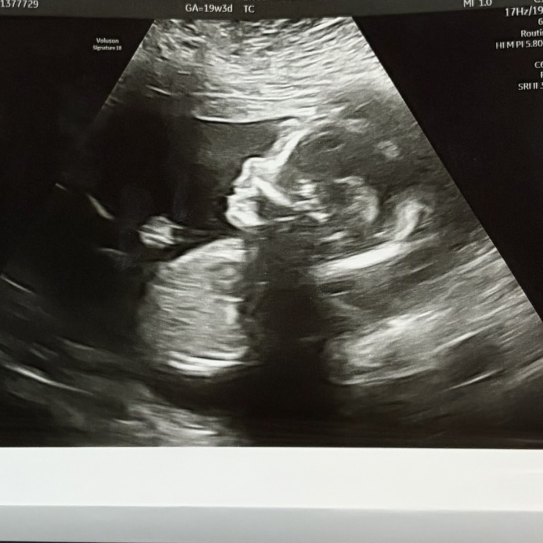 Photo shared by Amy for their Babylist baby registry.