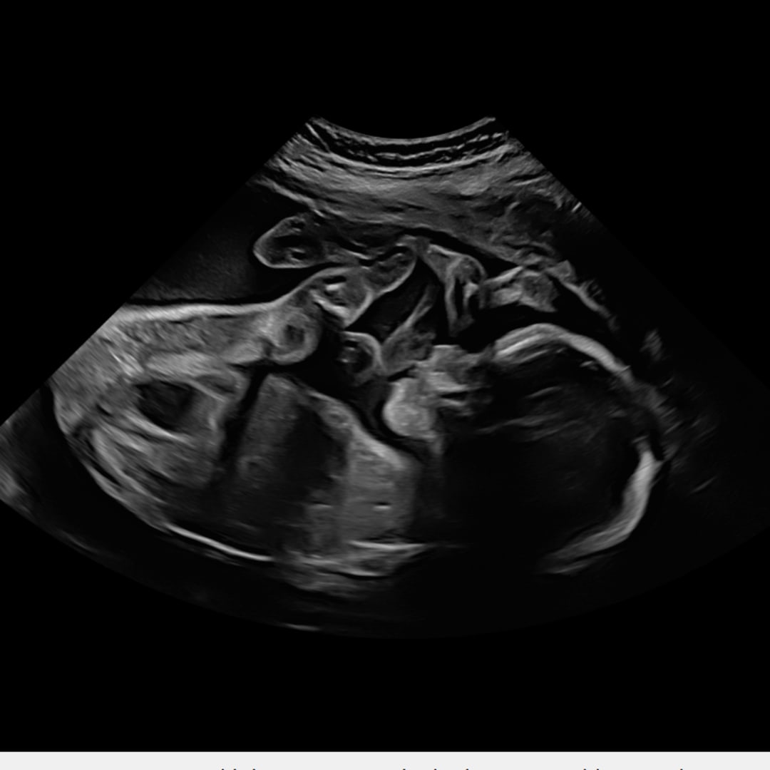 Photo shared by Destiny for their Babylist baby registry.