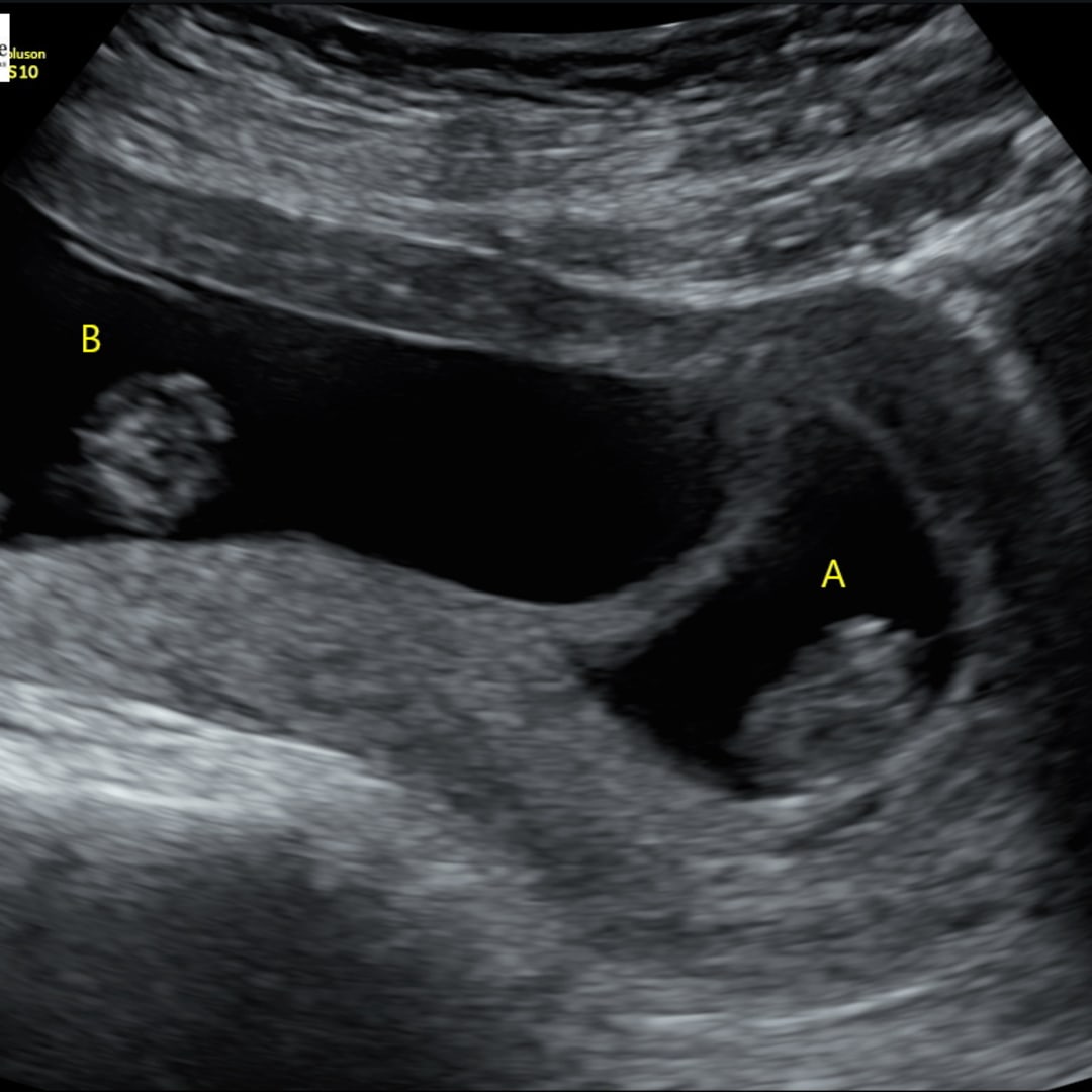 Photo shared by Micah for their Babylist baby registry.