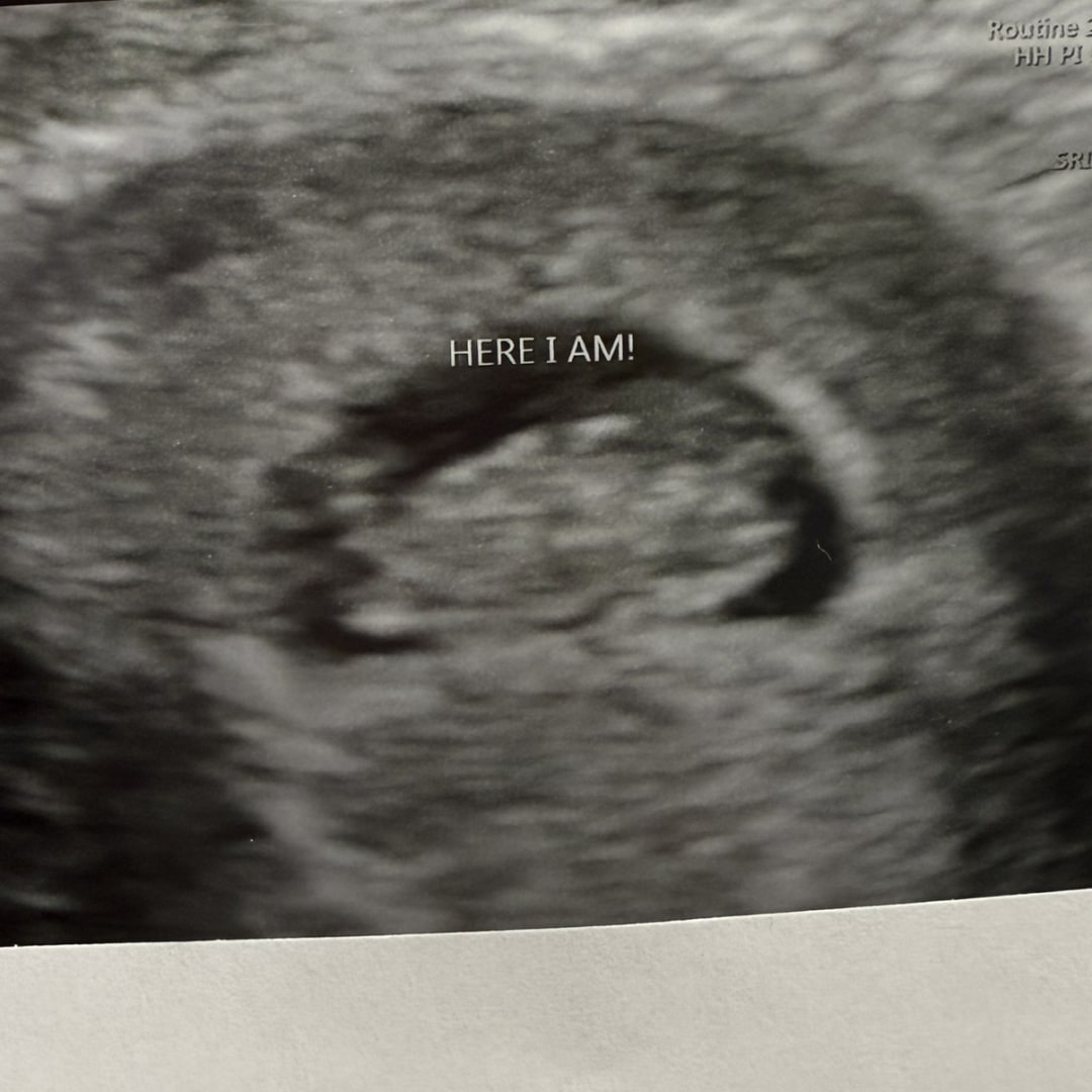 Photo shared by Tara for their Babylist baby registry.