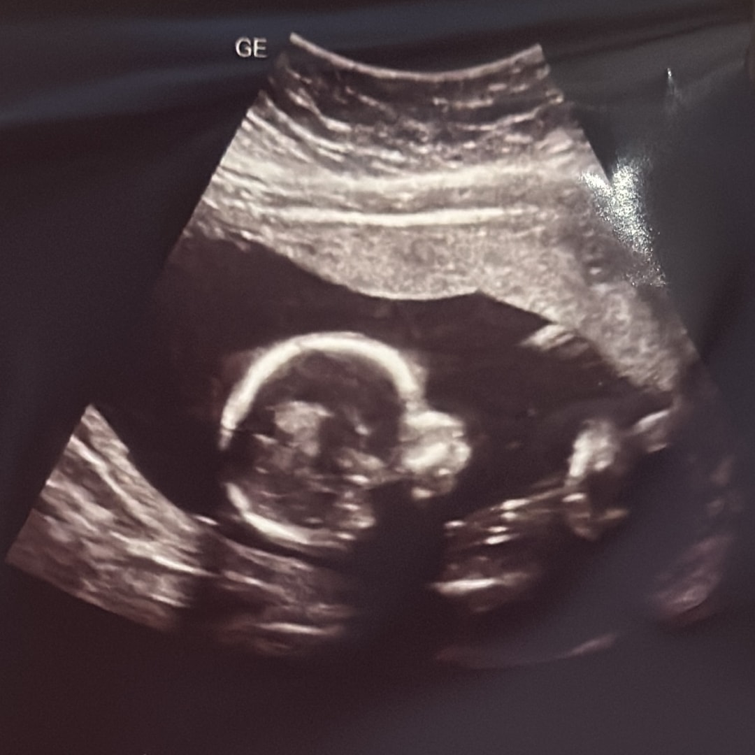 Photo shared by Esther for their Babylist baby registry.