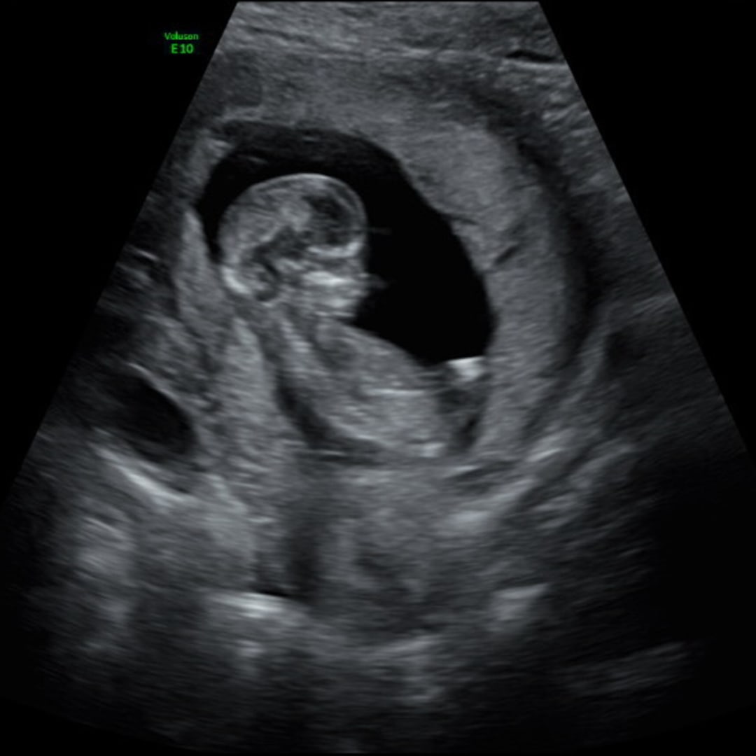 Photo shared by Gracie for their Babylist baby registry.