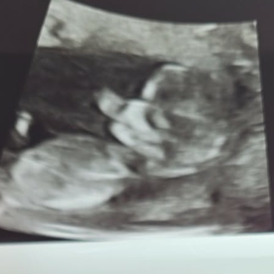 Photo shared by Madison for their Babylist baby registry.