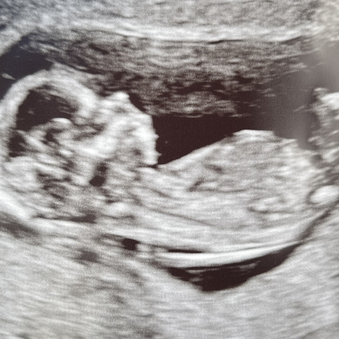 Photo shared by Christianna for their Babylist baby registry.