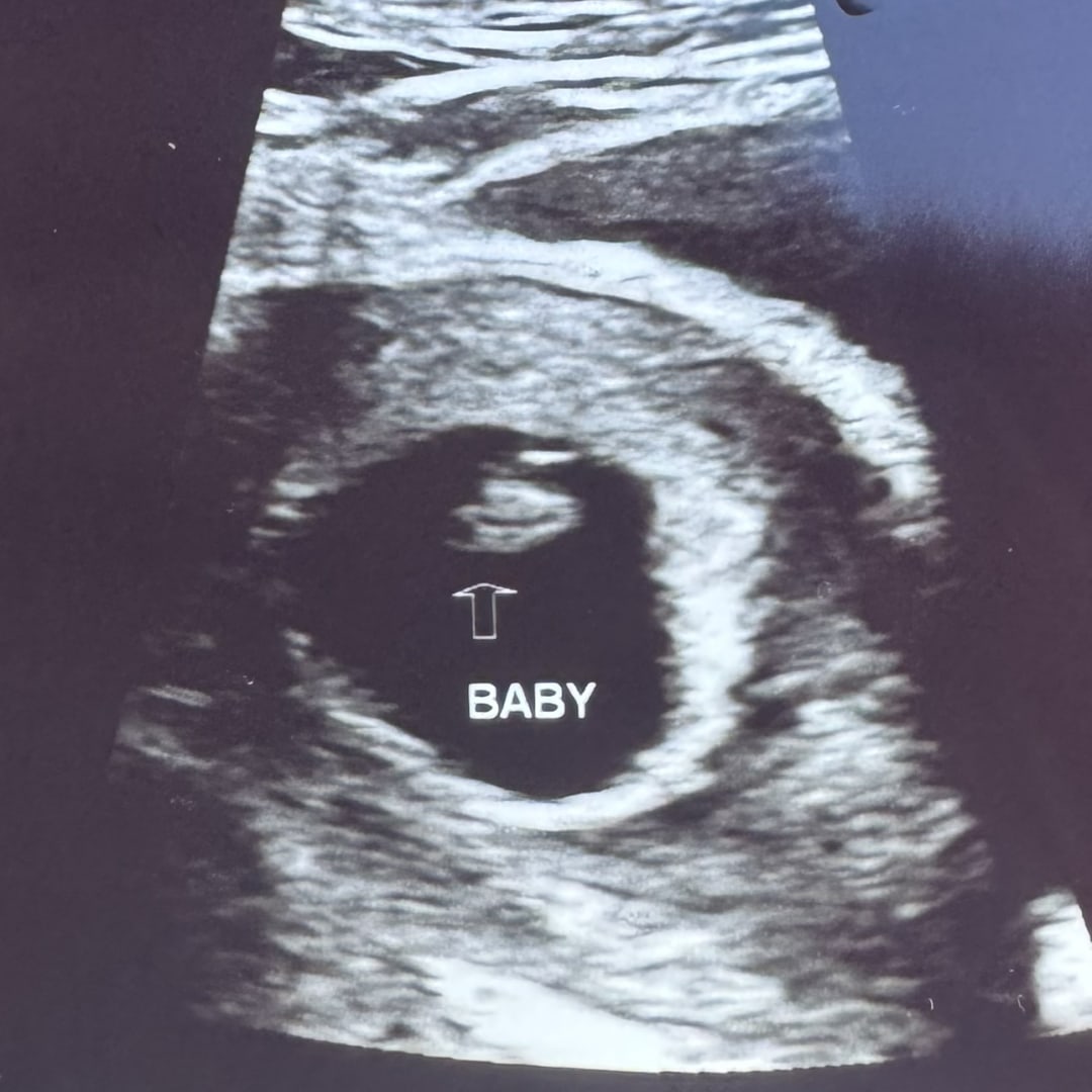 Photo shared by Amayrany for their Babylist baby registry.
