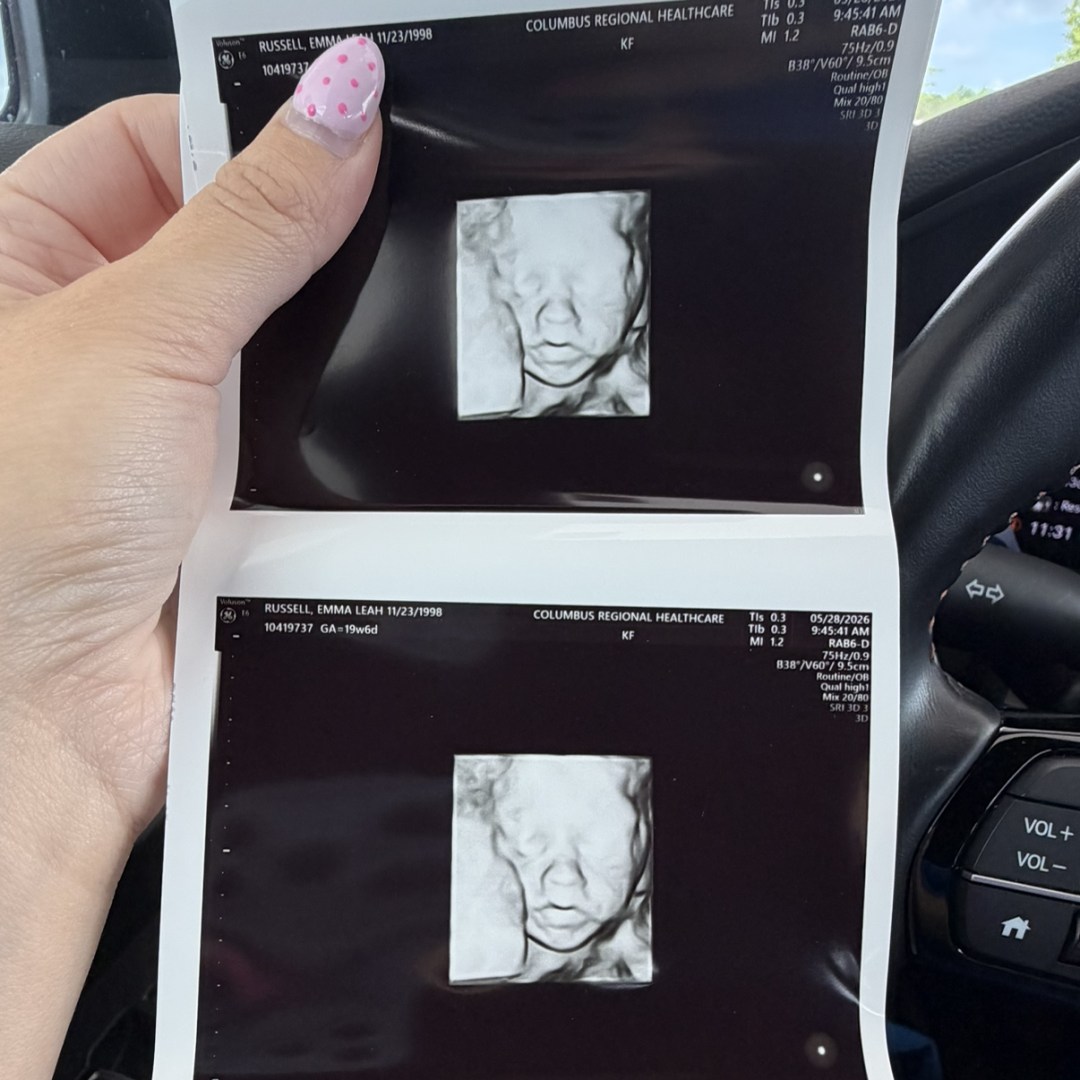 Photo shared by Emma for their Babylist baby registry.