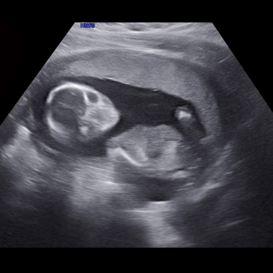 Photo shared by Britlynn for their Babylist baby registry.