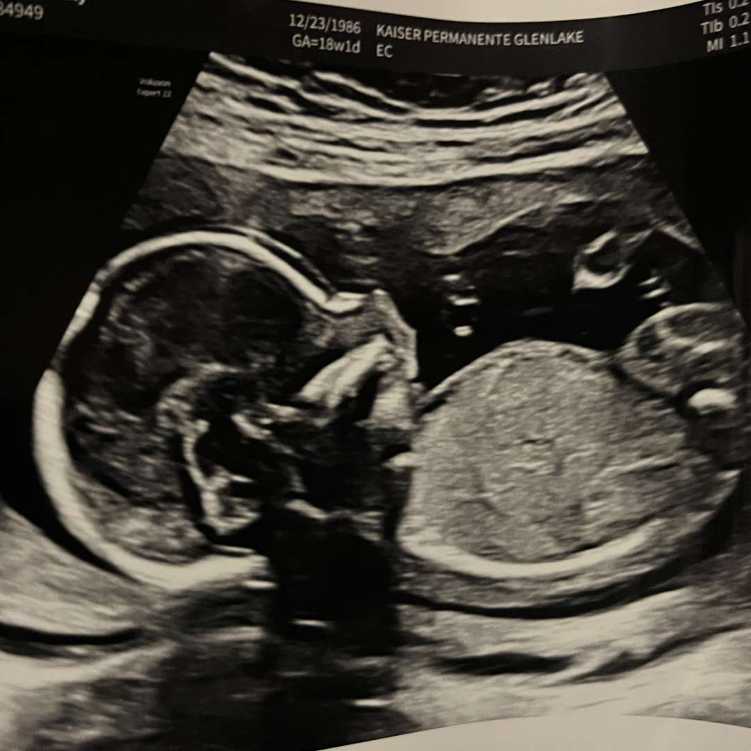 Photo shared by Emily for their Babylist baby registry.