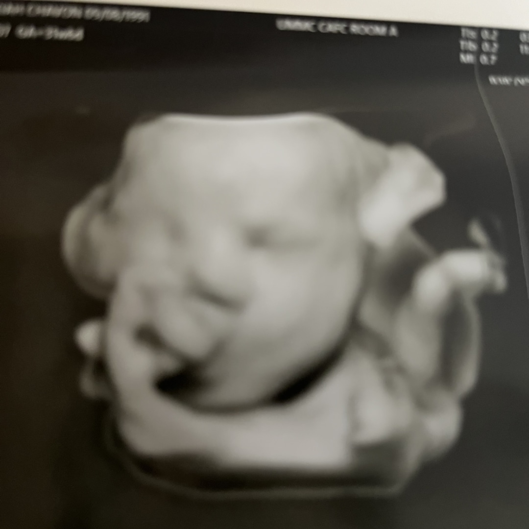 Photo shared by Kiah for their Babylist baby registry.