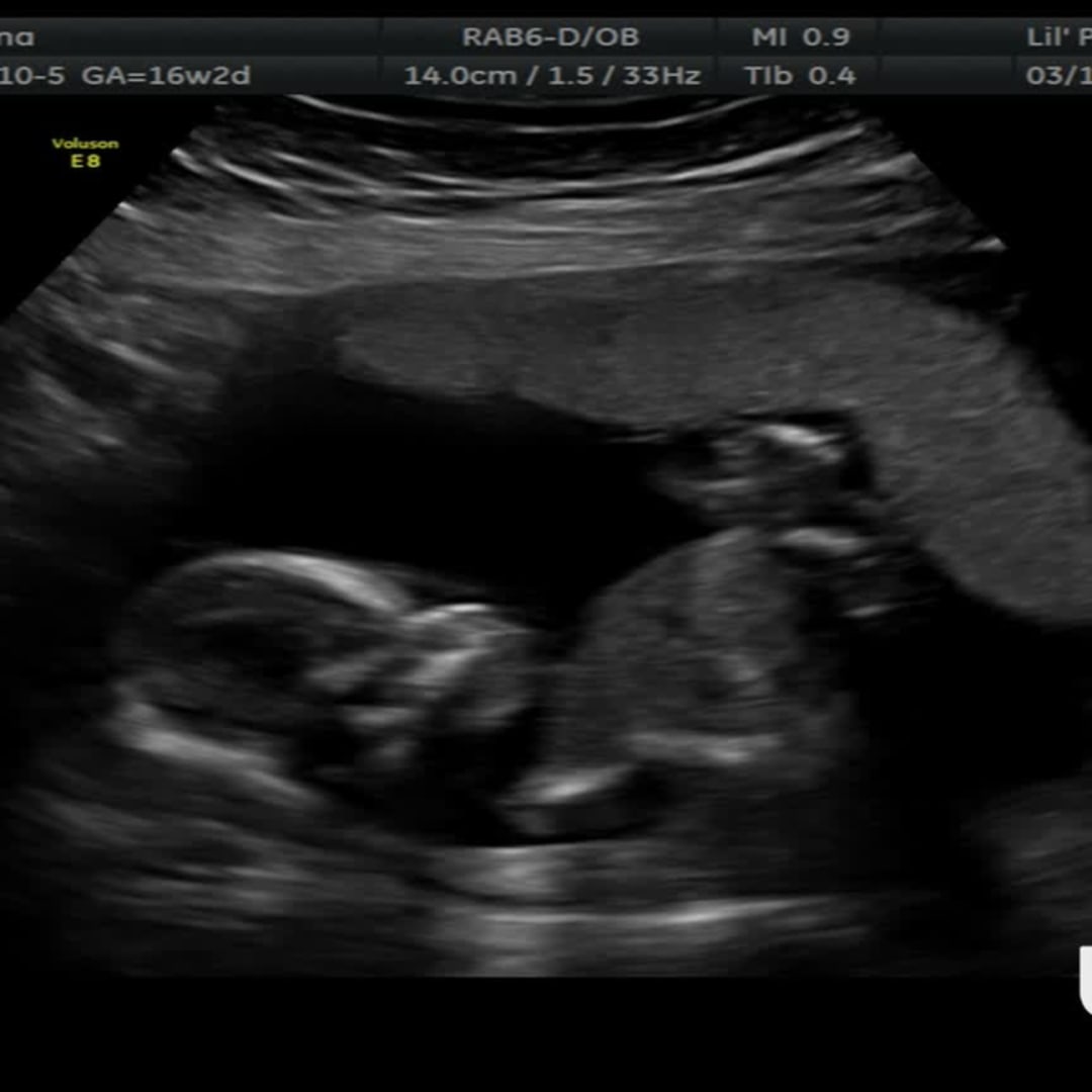 Photo shared by Justina for their Babylist baby registry.