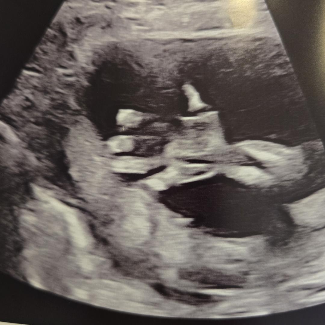Photo shared by Denise for their Babylist baby registry.