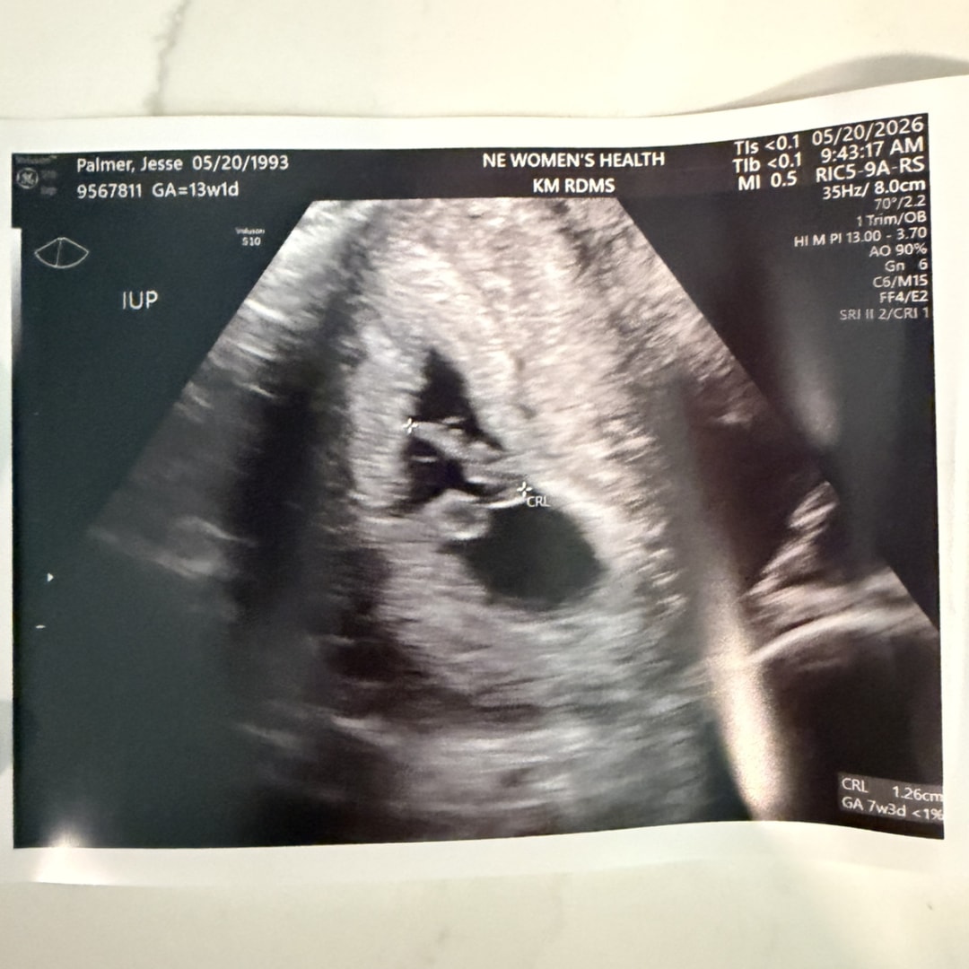 Photo shared by Austin for their Babylist baby registry.