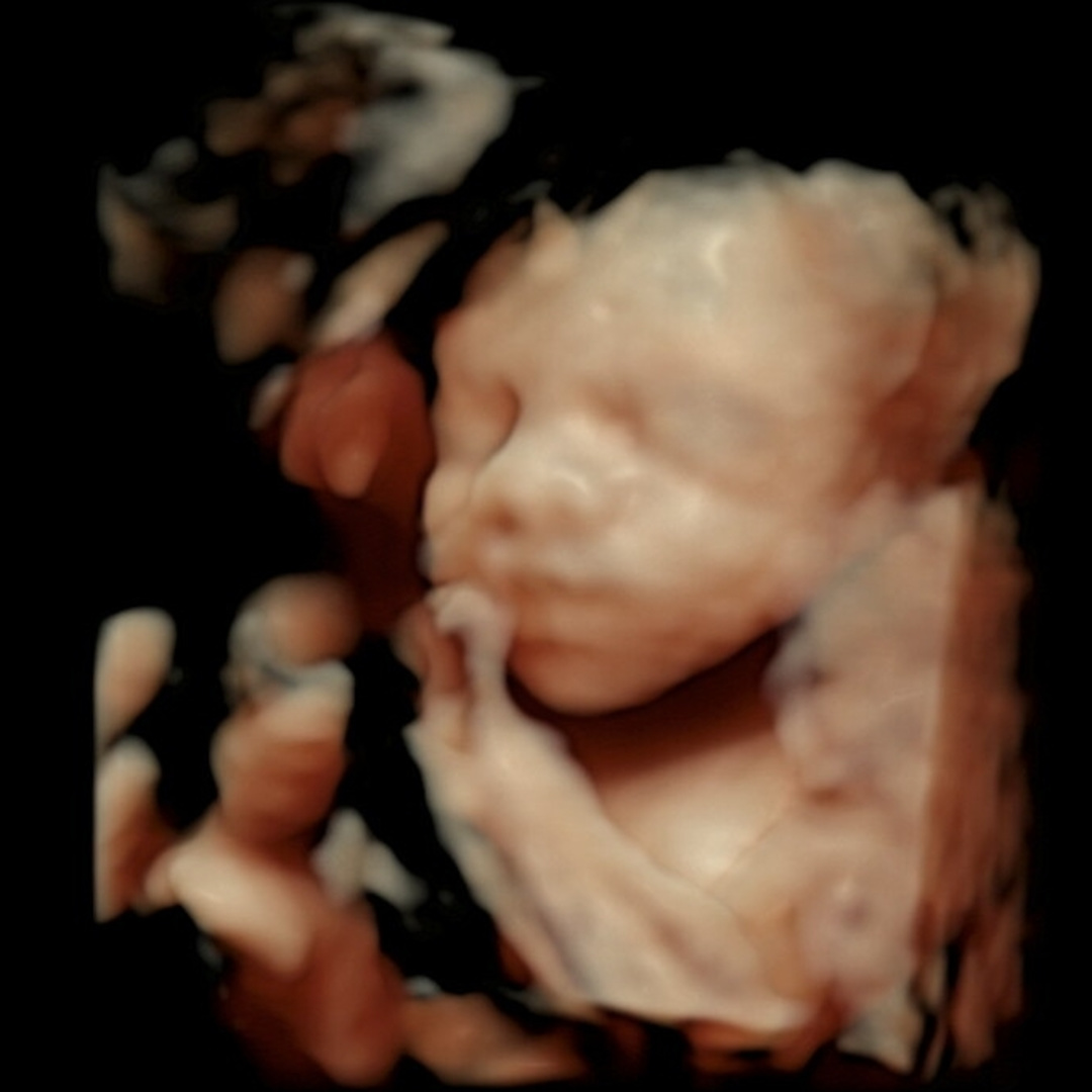 Photo shared by Harriet for their Babylist baby registry.
