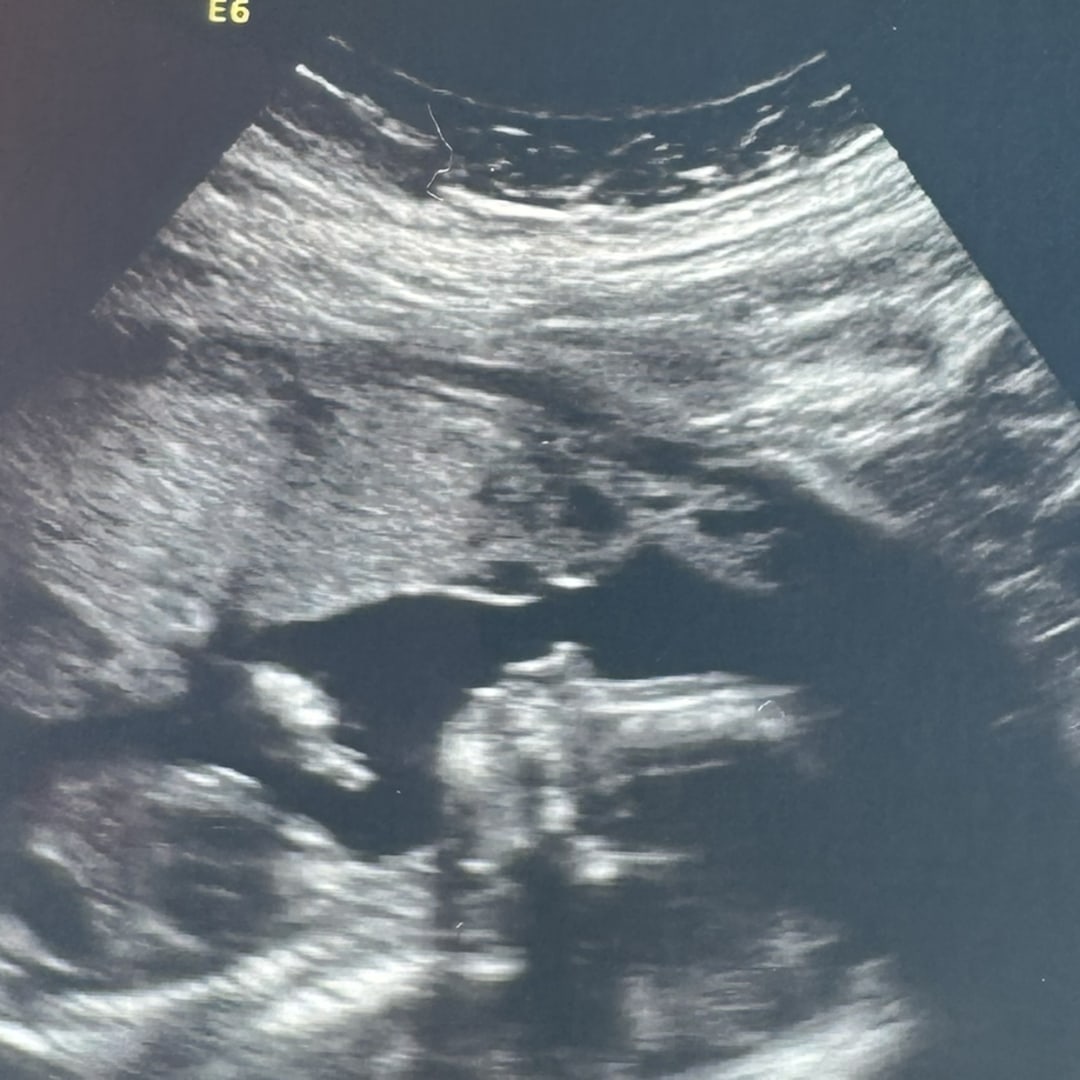 Photo shared by Amanda for their Babylist baby registry.