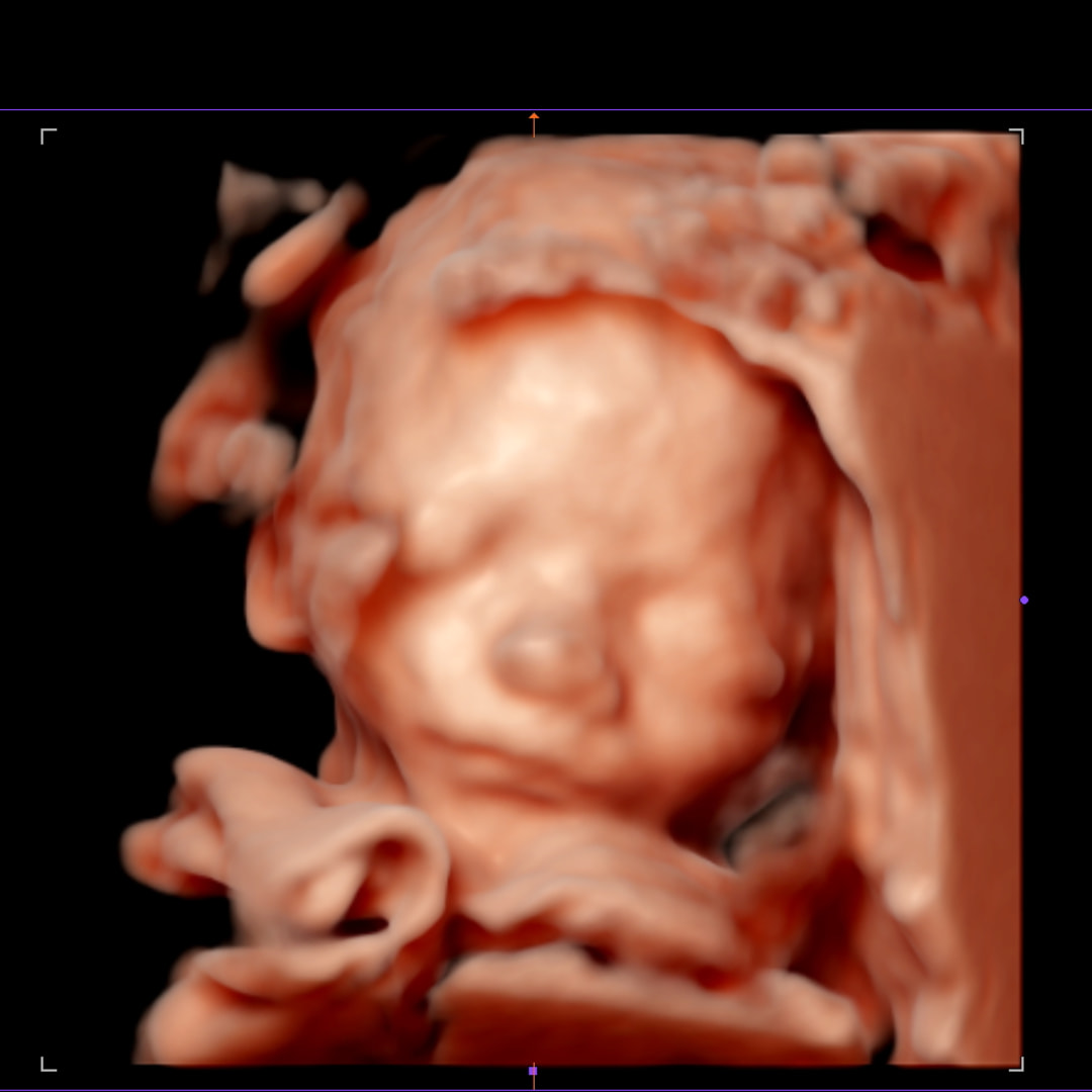 Photo shared by Alexis for their Babylist baby registry.