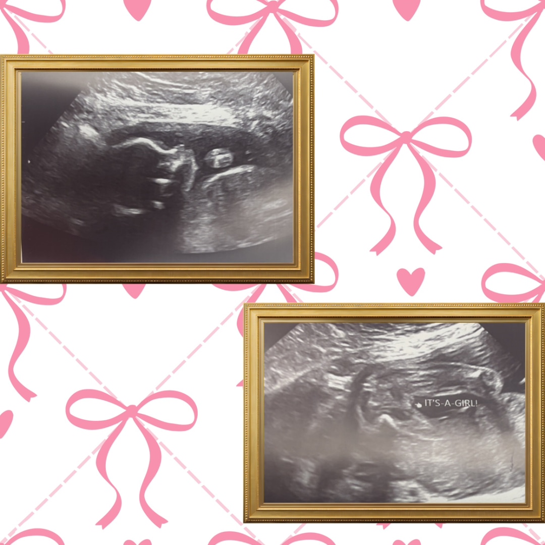 Photo shared by Alana for their Babylist baby registry.