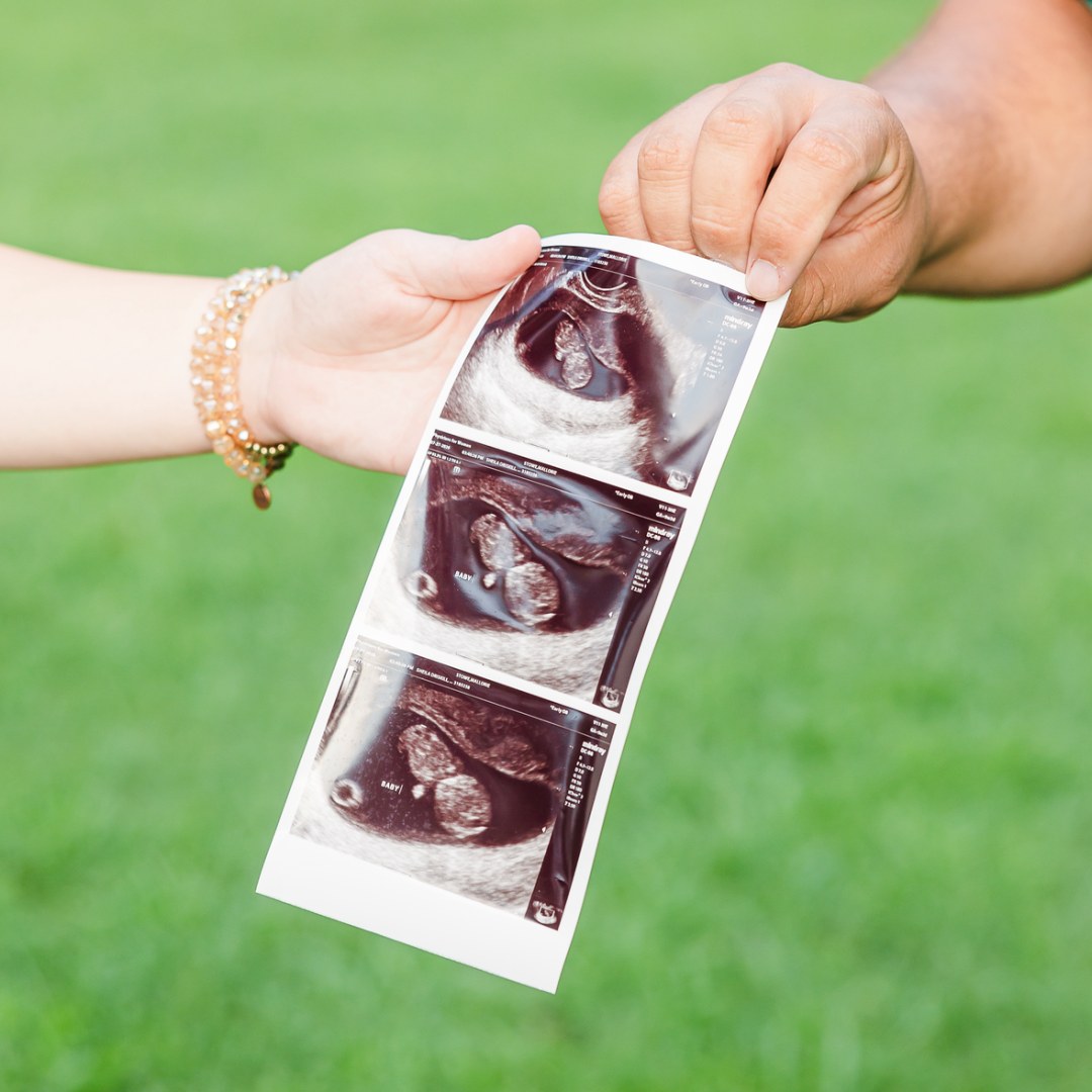 Photo shared by Mallorie for their Babylist baby registry.