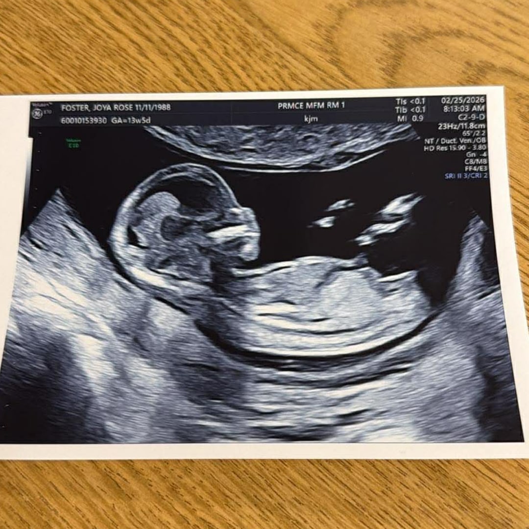 Photo shared by Joya for their Babylist baby registry.