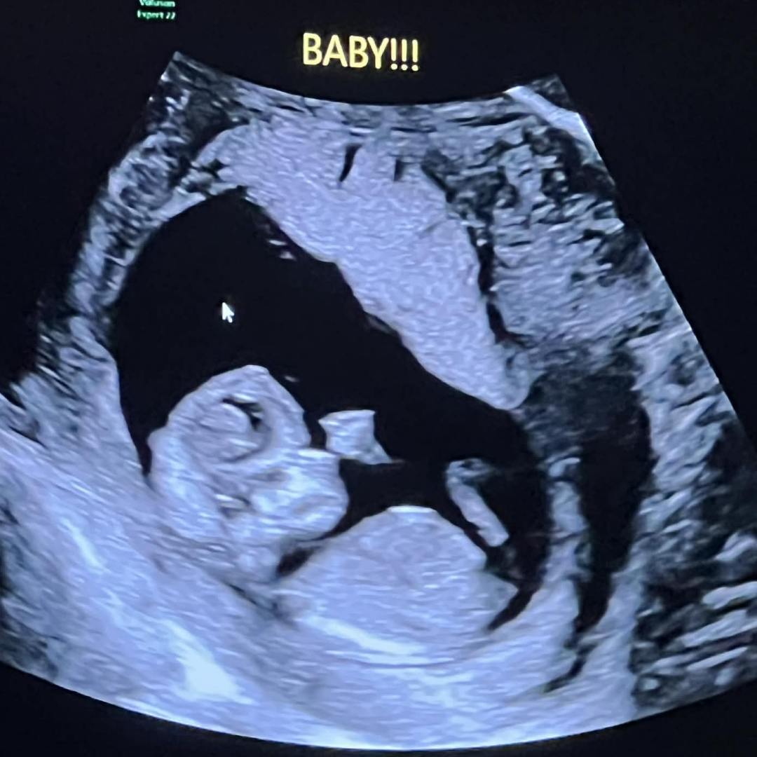 Photo shared by Elizabeth for their Babylist baby registry.