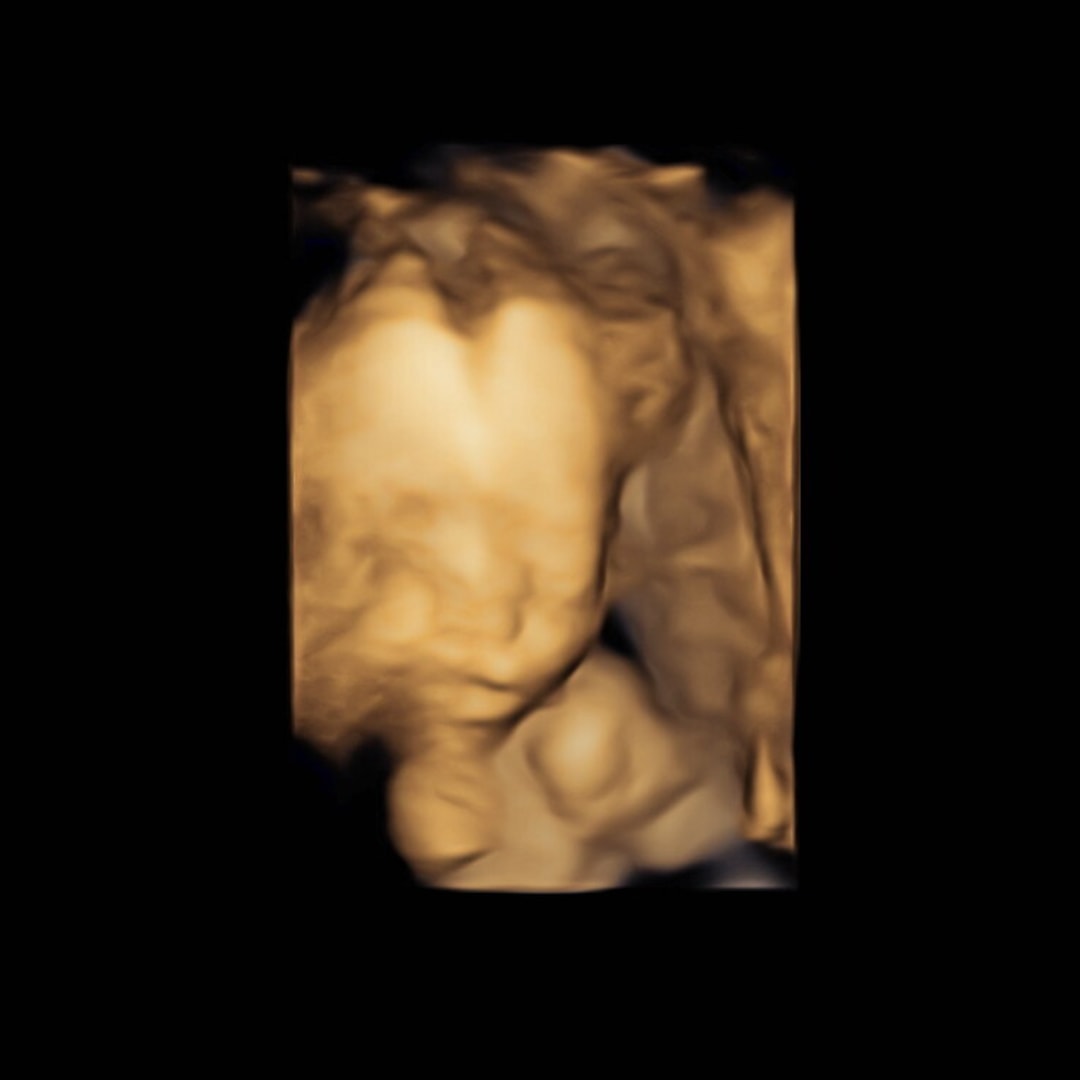 Photo shared by Grace for their Babylist baby registry.
