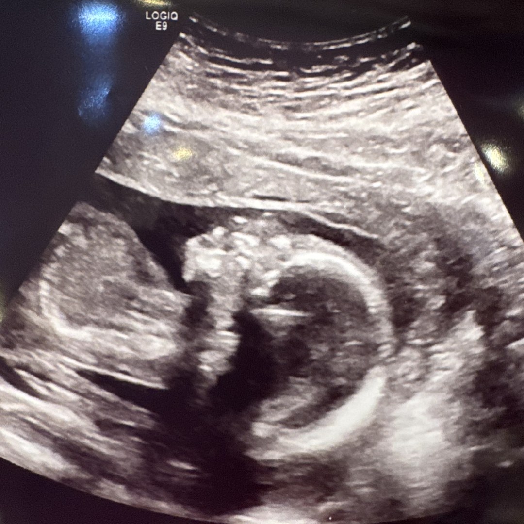 Photo shared by Cynthia for their Babylist baby registry.