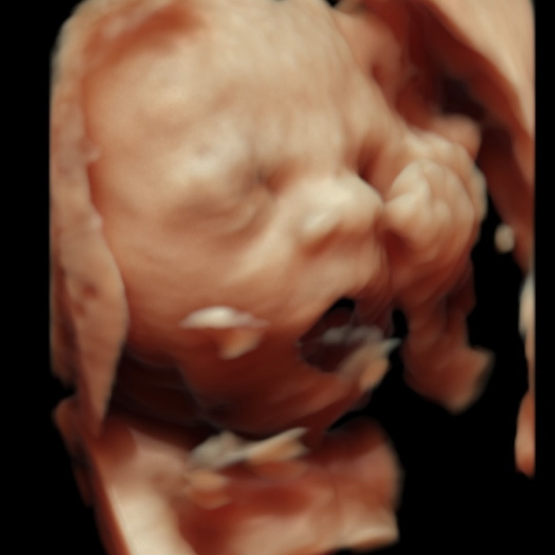 Photo shared by Madi for their Babylist baby registry.