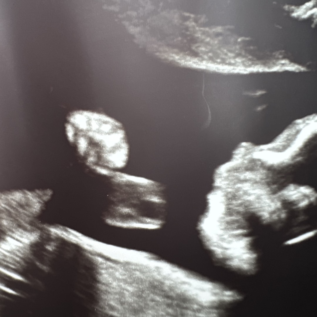 Photo shared by Elizabeth for their Babylist baby registry.