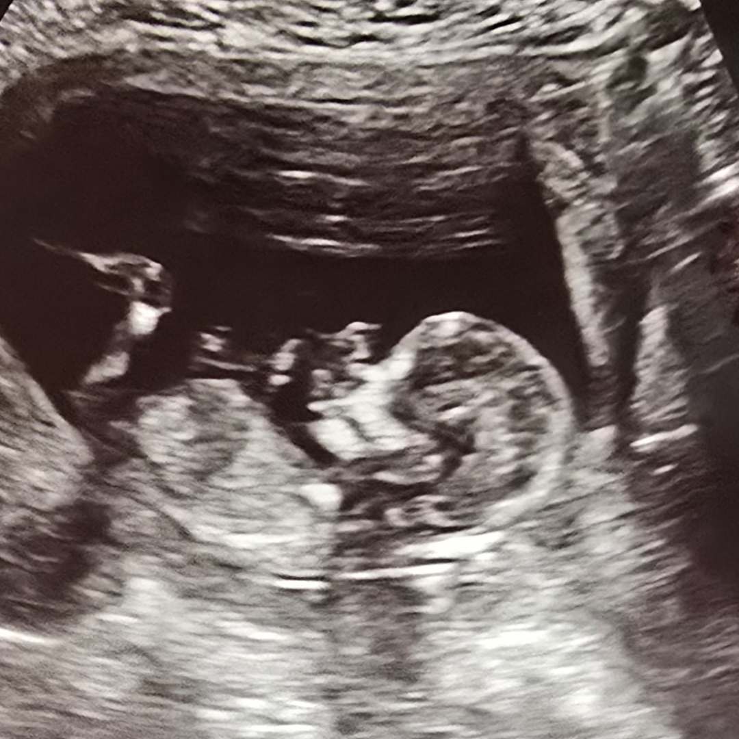 Photo shared by Katie for their Babylist baby registry.