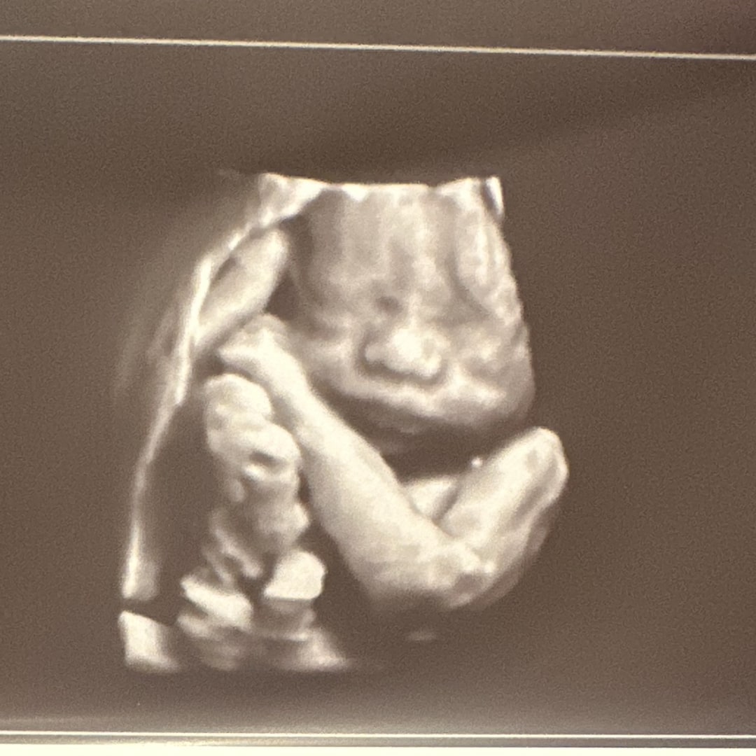 Photo shared by Alex for their Babylist baby registry.