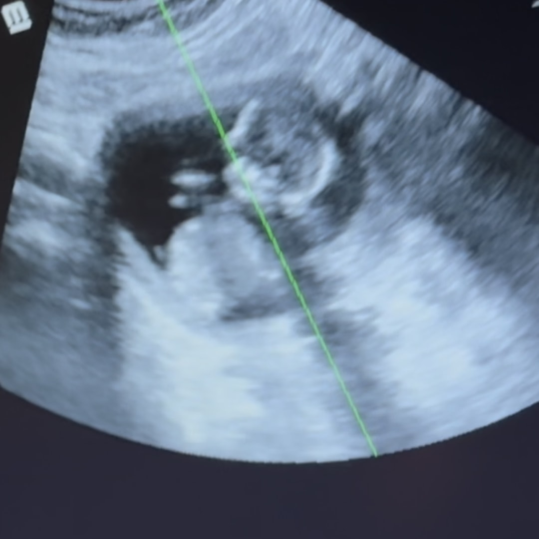 Photo shared by Ashley for their Babylist baby registry.