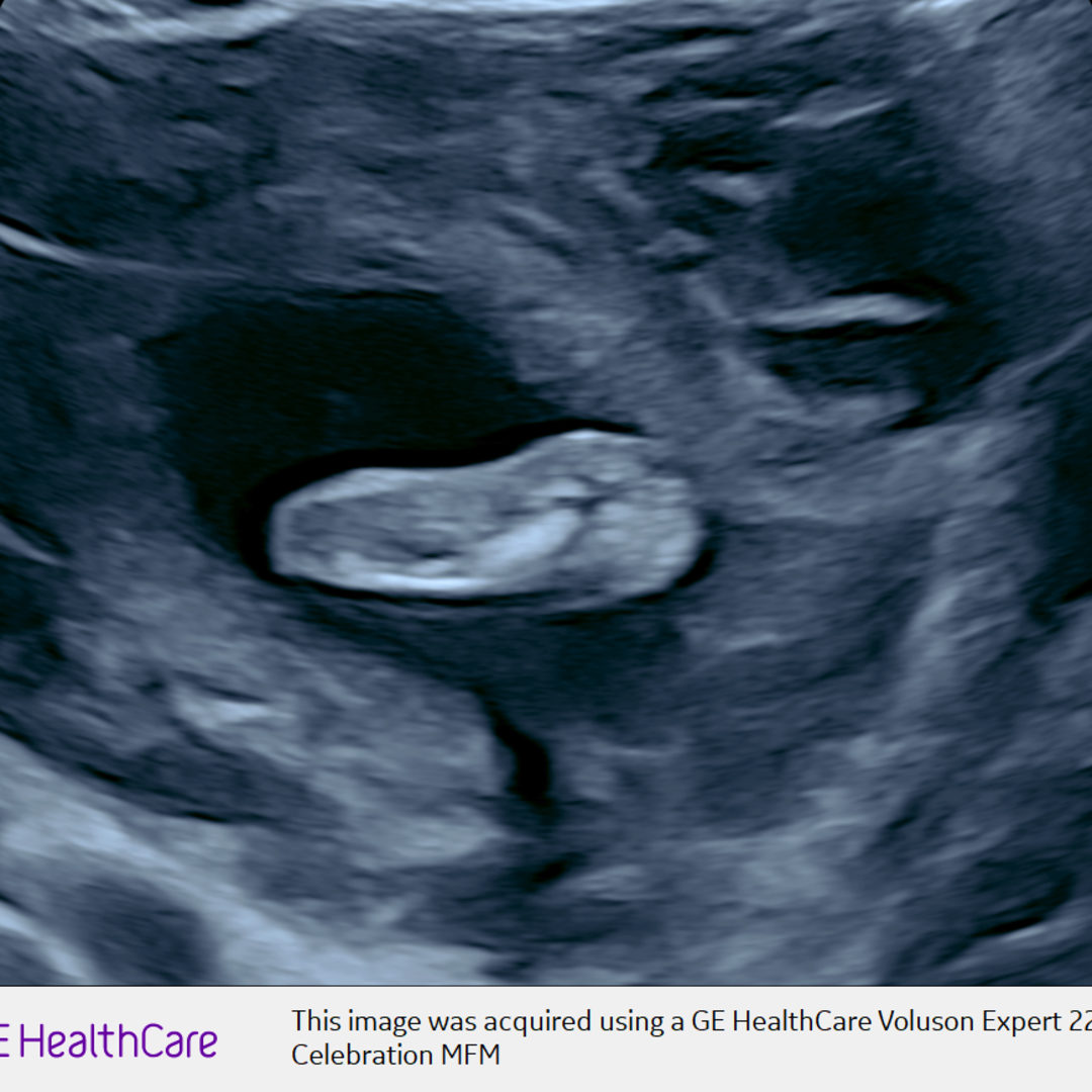 Photo shared by Raechel for their Babylist baby registry.