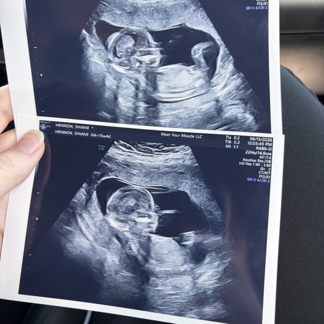 Photo shared by Shiane for their Babylist baby registry.