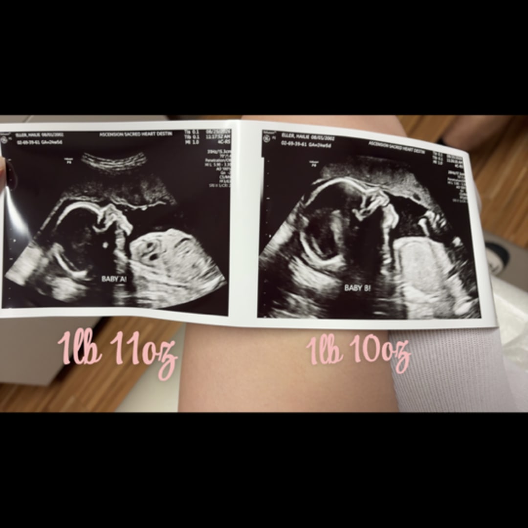 Photo shared by Hailie for their Babylist baby registry.