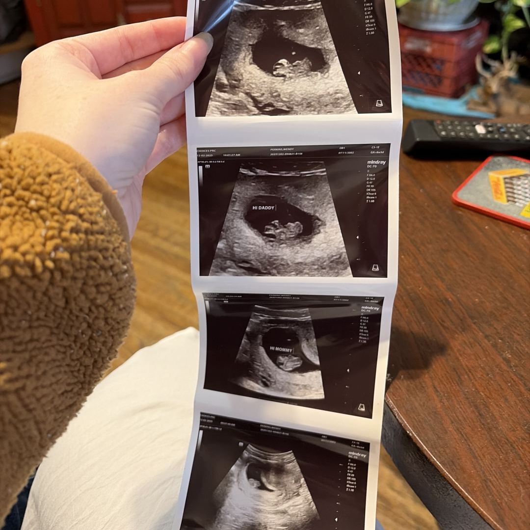 Photo shared by Mckenzie for their Babylist baby registry.