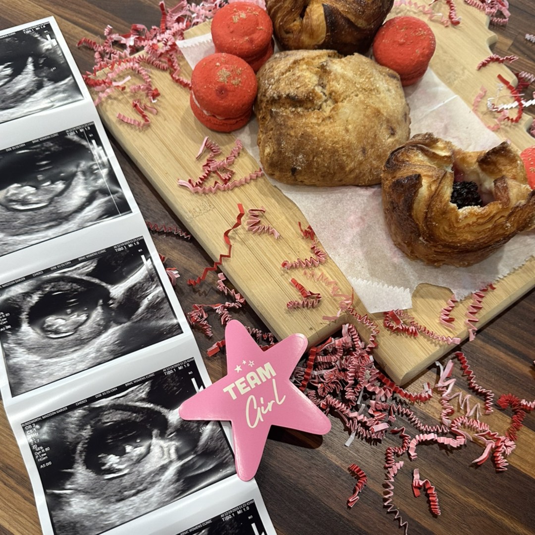 Photo shared by Madison for their Babylist baby registry.