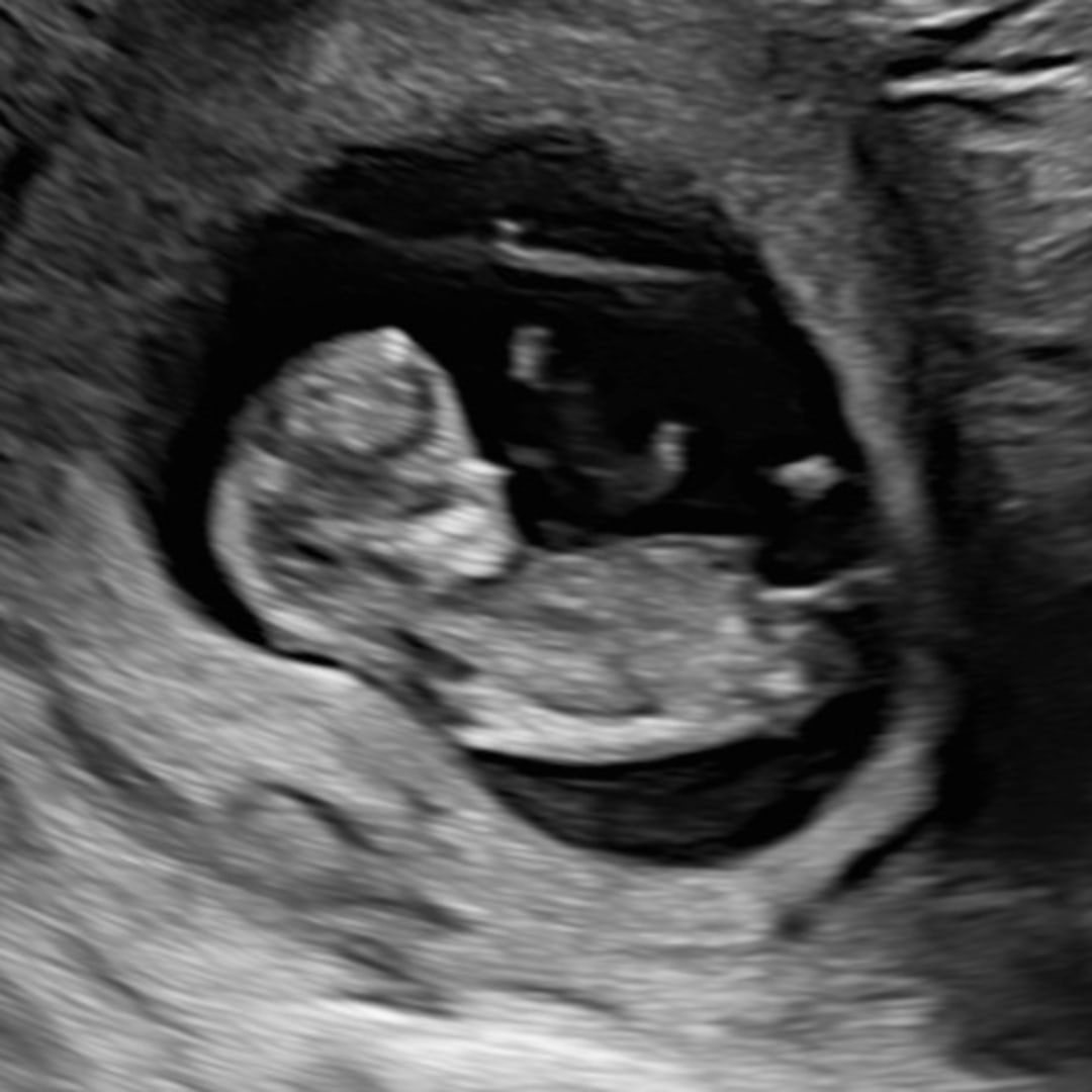 Photo shared by Raelee for their Babylist baby registry.