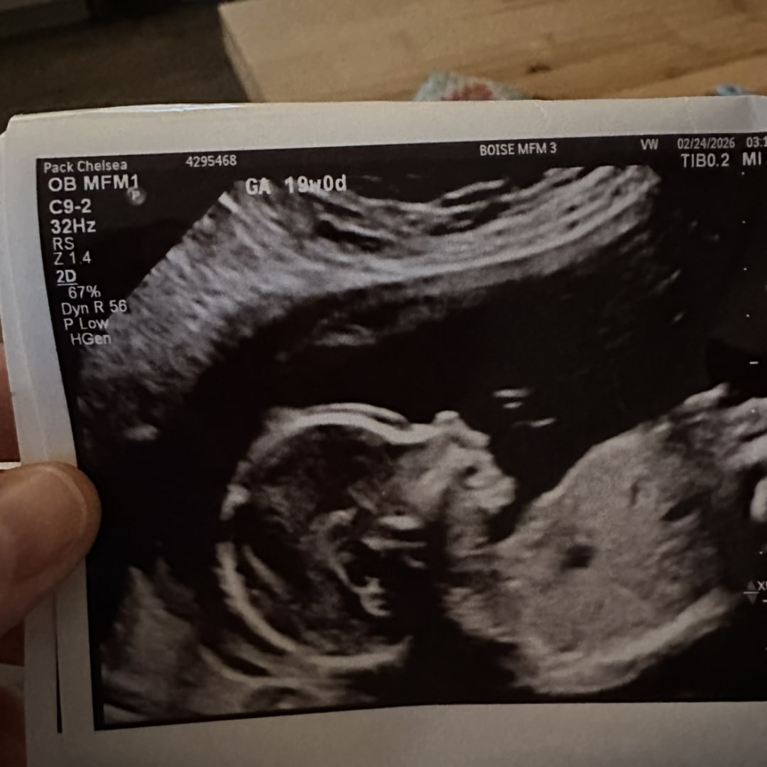 Photo shared by Chelsea for their Babylist baby registry.