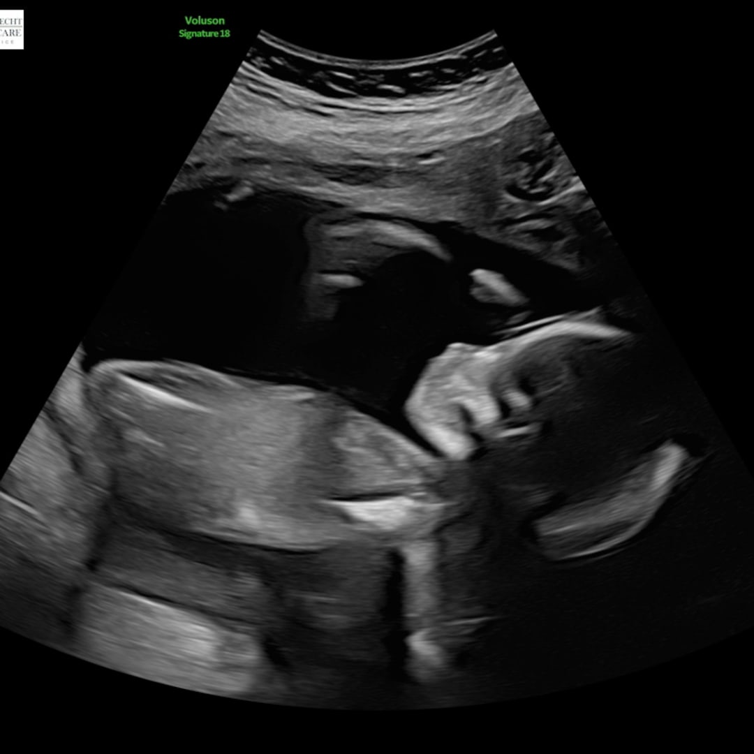 Photo shared by Marisa for their Babylist baby registry.
