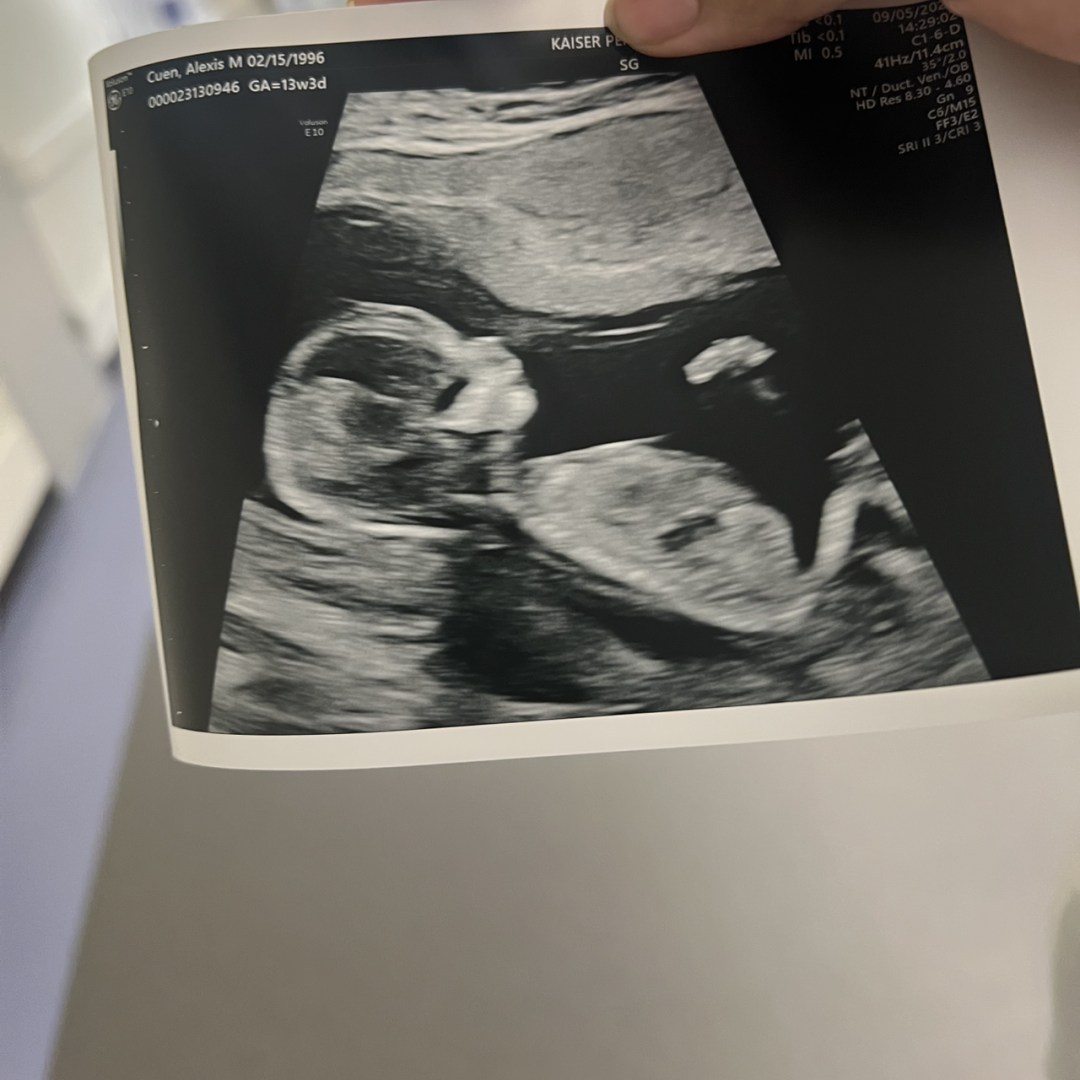 Photo shared by Alexis for their Babylist baby registry.