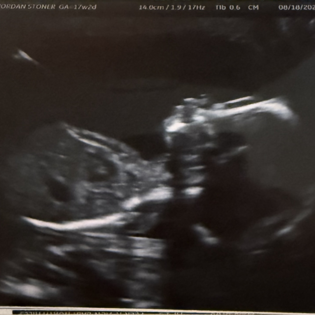 Photo shared by Jordan for their Babylist baby registry.