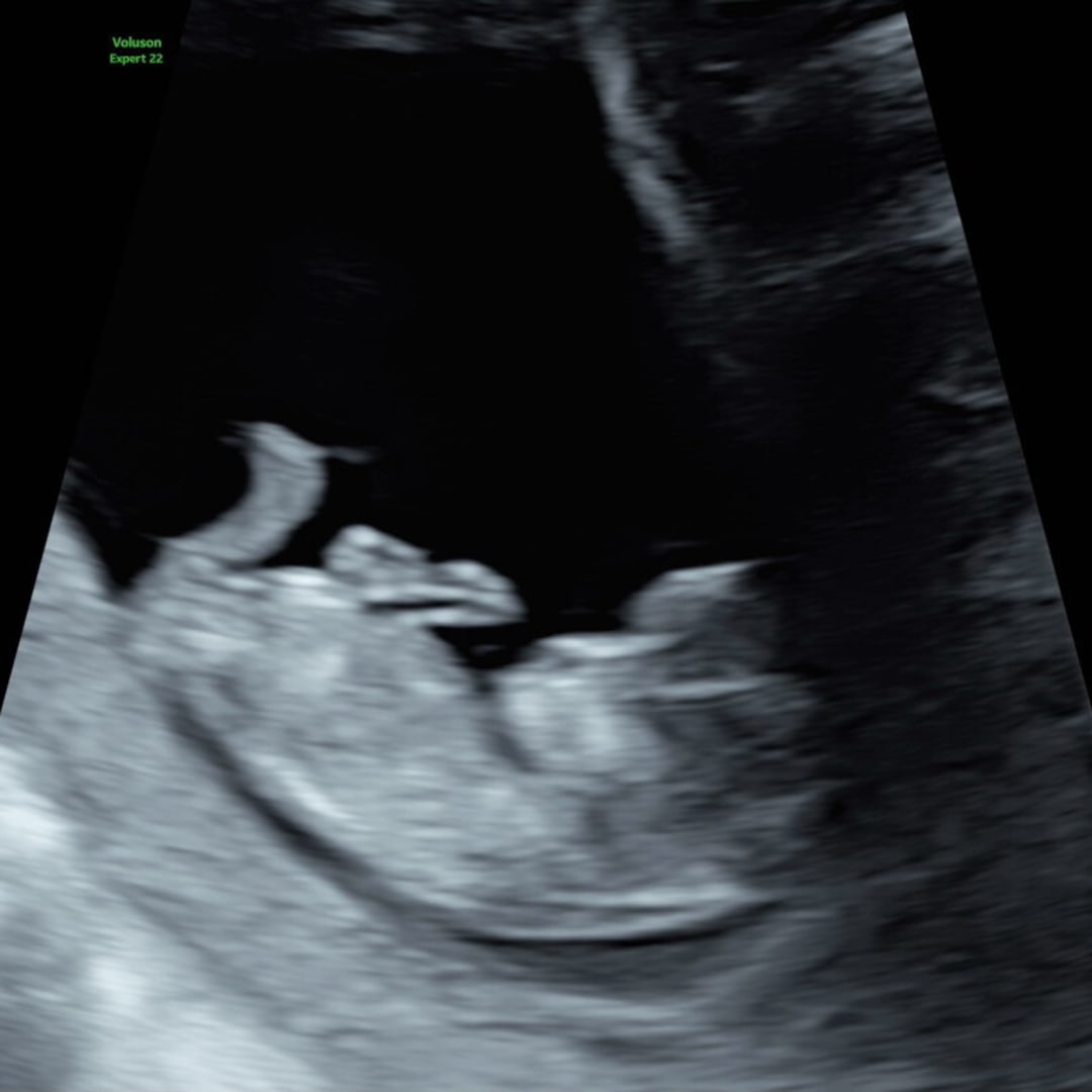 Photo shared by Anna for their Babylist baby registry.