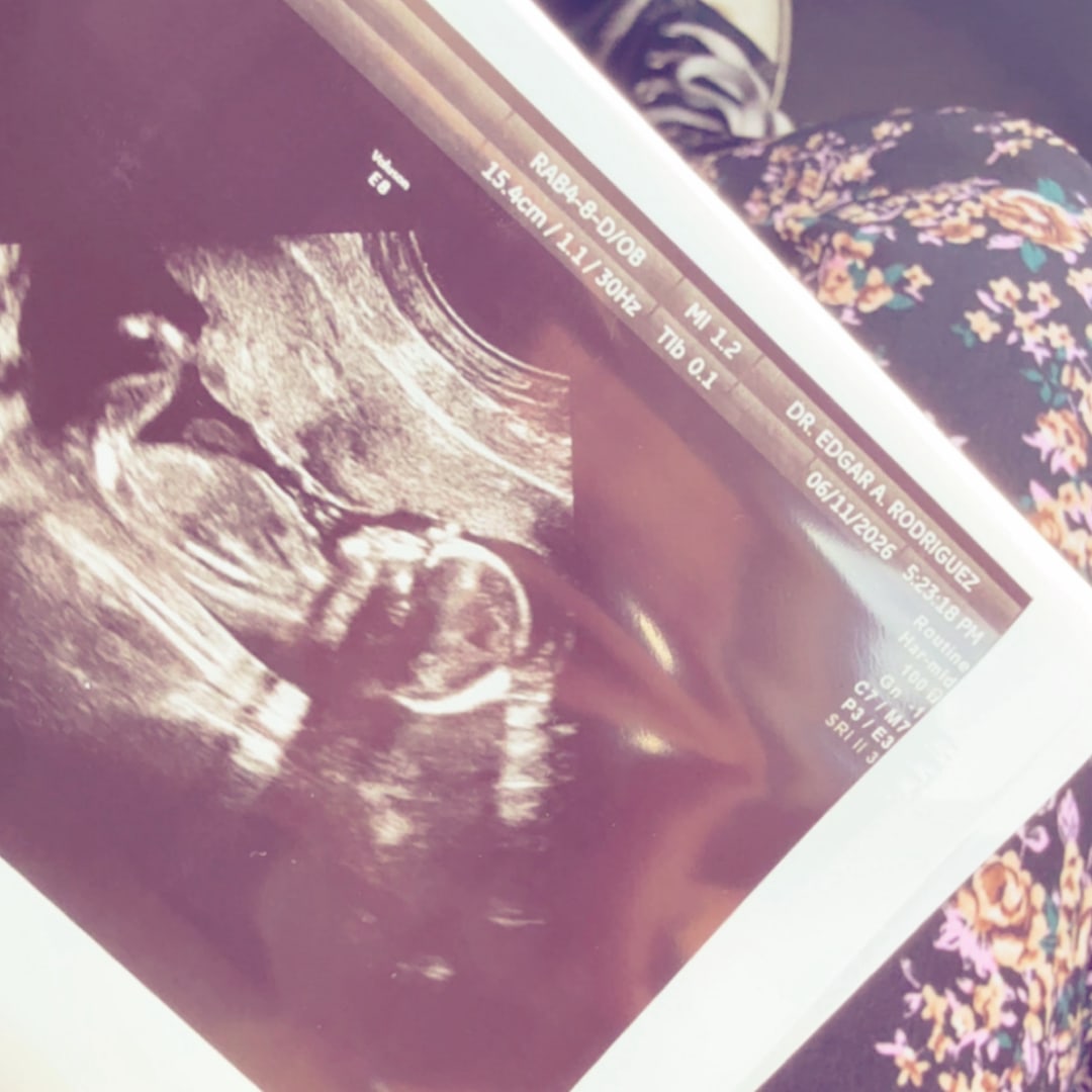Photo shared by Amanda for their Babylist baby registry.