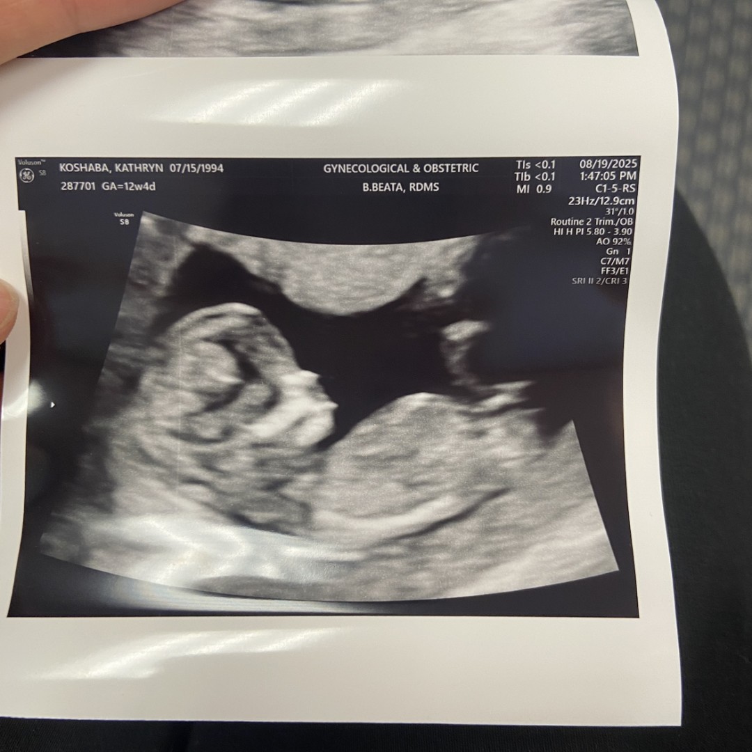 Photo shared by Kathryn for their Babylist baby registry.