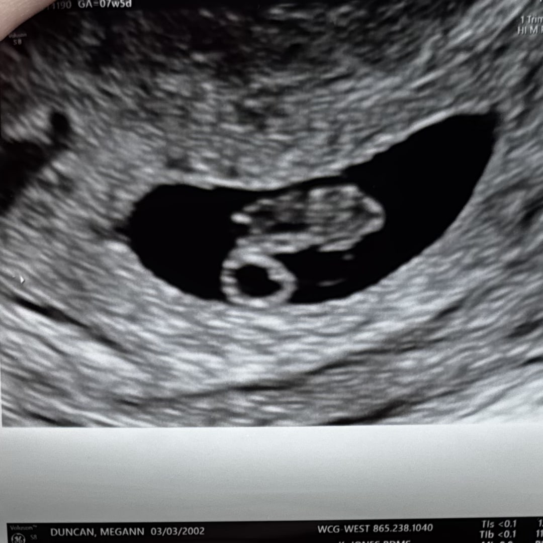 Photo shared by Megann for their Babylist baby registry.