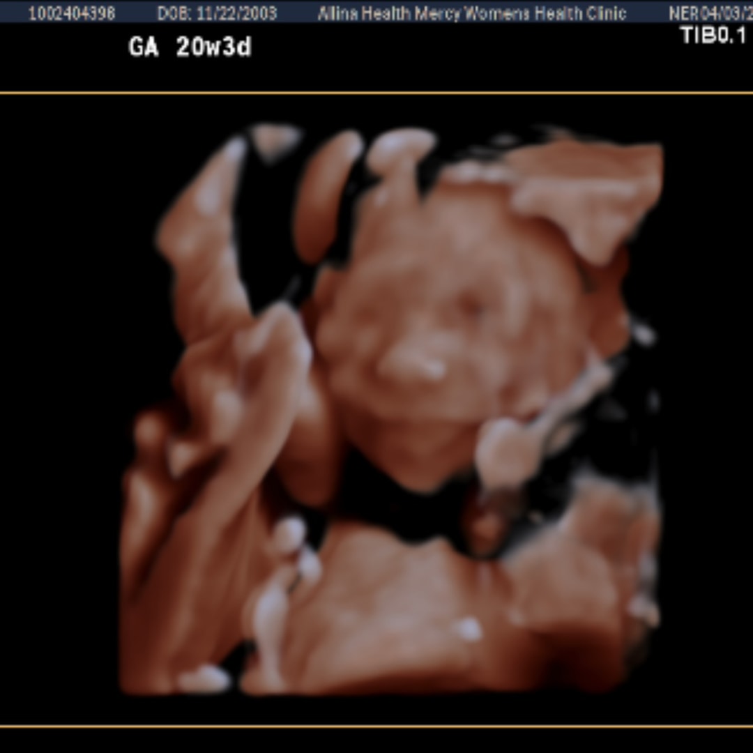 Photo shared by Mya for their Babylist baby registry.