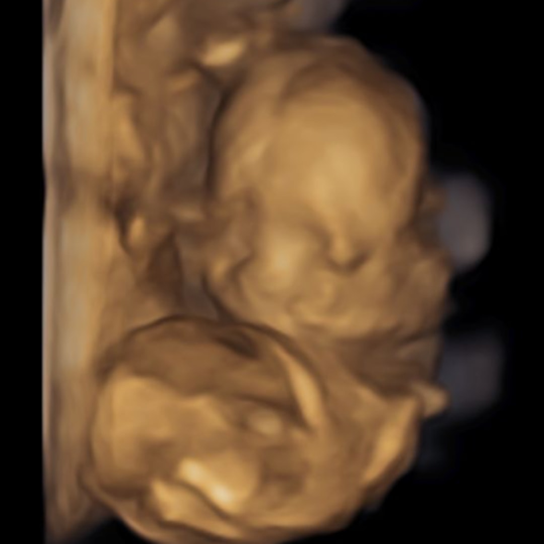 Photo shared by Kaitlyn for their Babylist baby registry.