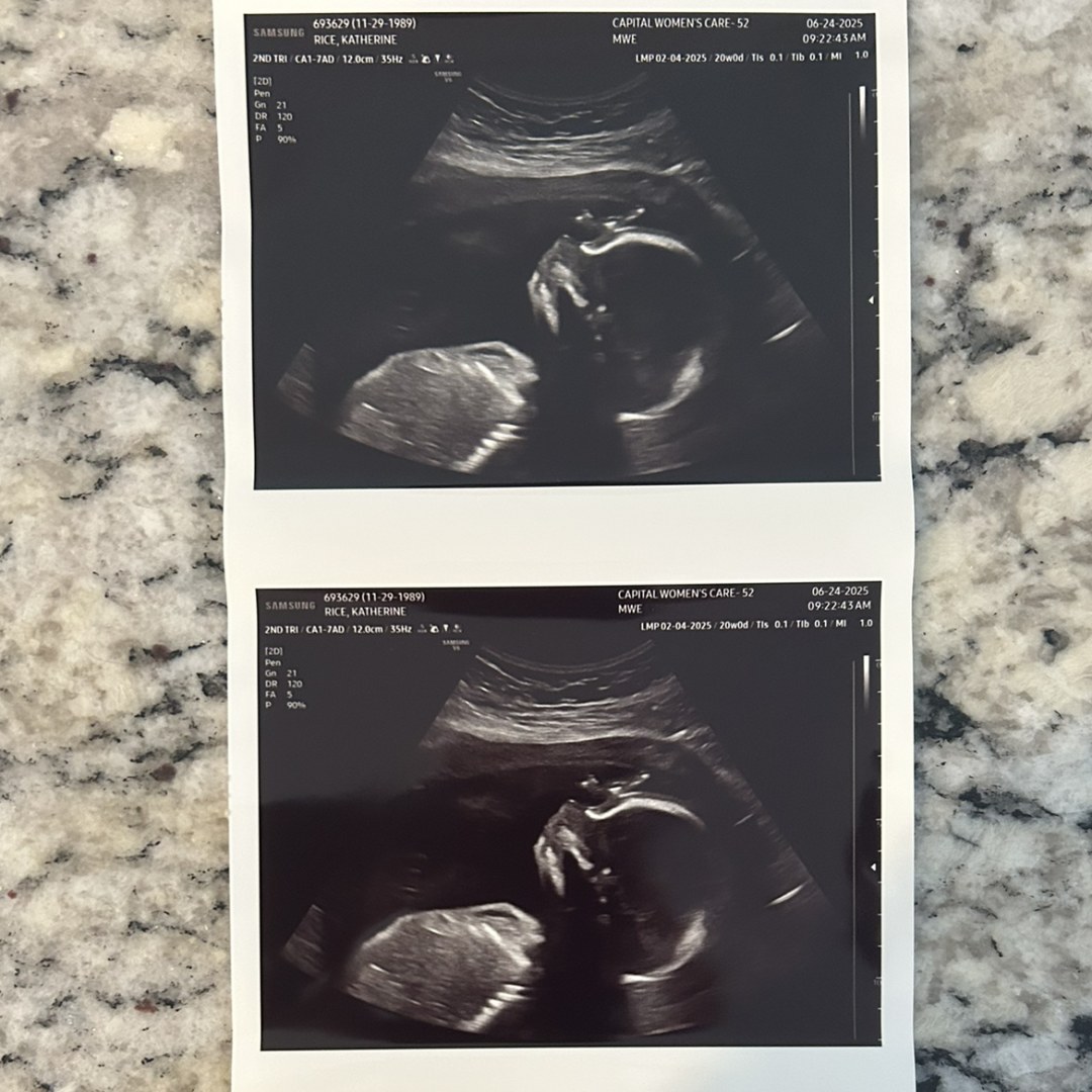 Photo shared by Ben for their Babylist baby registry.