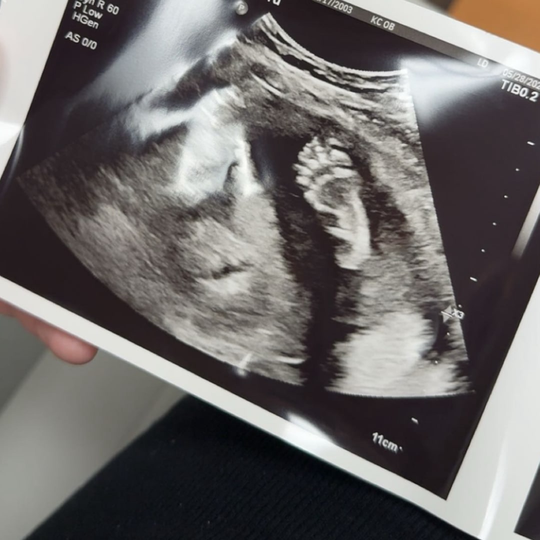 Photo shared by Abigail for their Babylist baby registry.