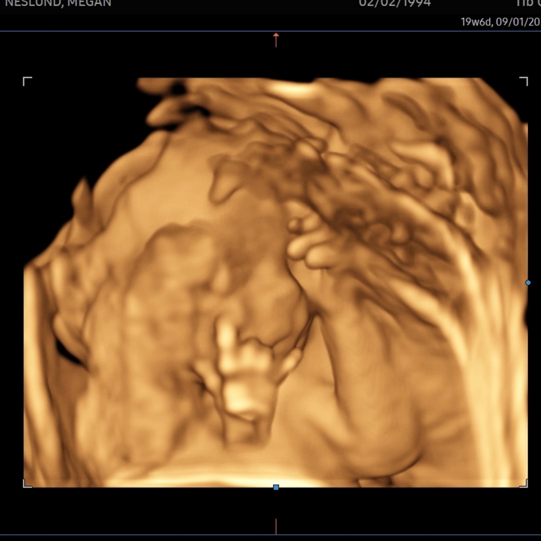 Photo shared by Megan for their Babylist baby registry.