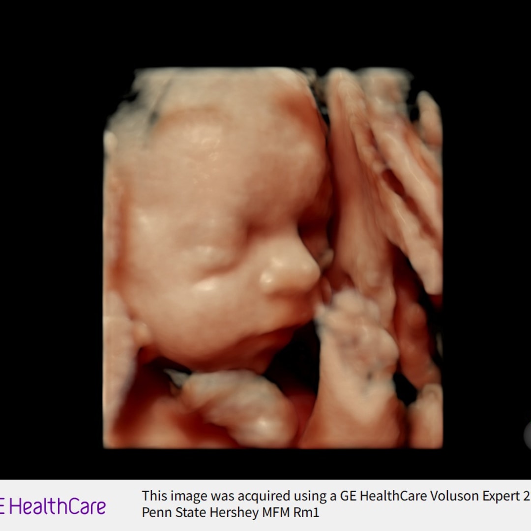 Photo shared by Hannah for their Babylist baby registry.
